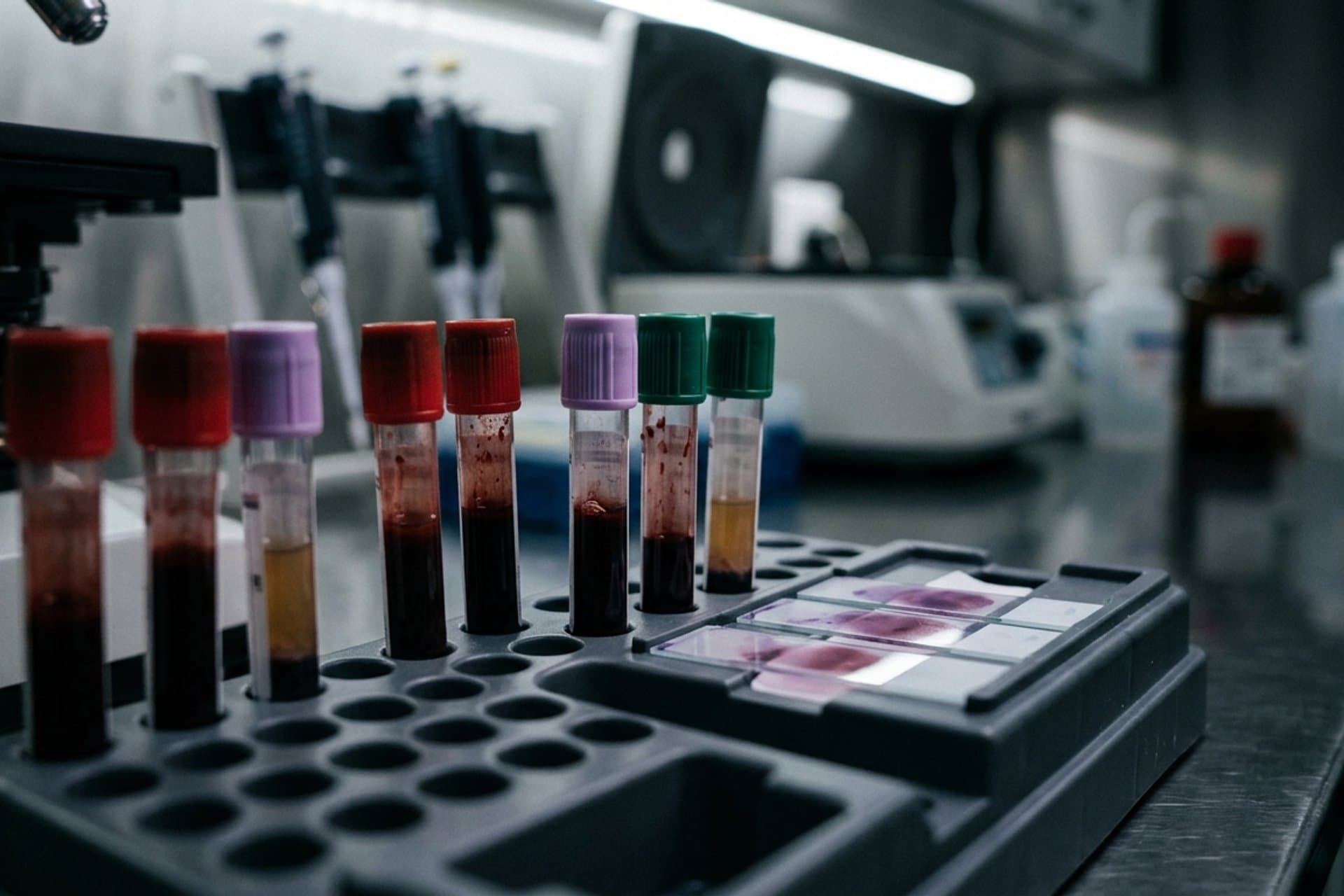 Anderen Erkrankungen, die das lymphoretikuläre Gewebe und das retikulo-histiozytäre System betreffen — medizin.studio