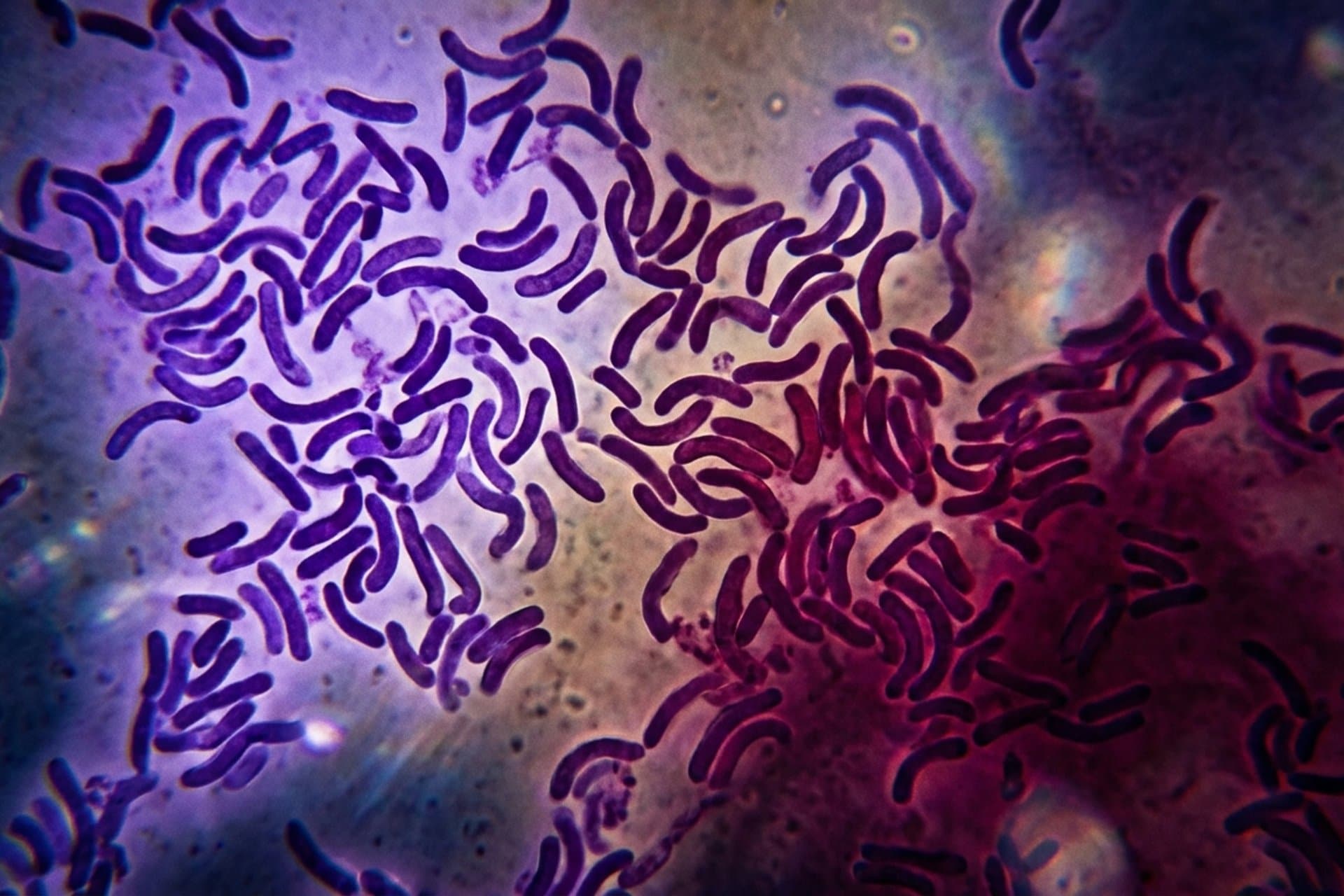 Cholera — medizin.studio