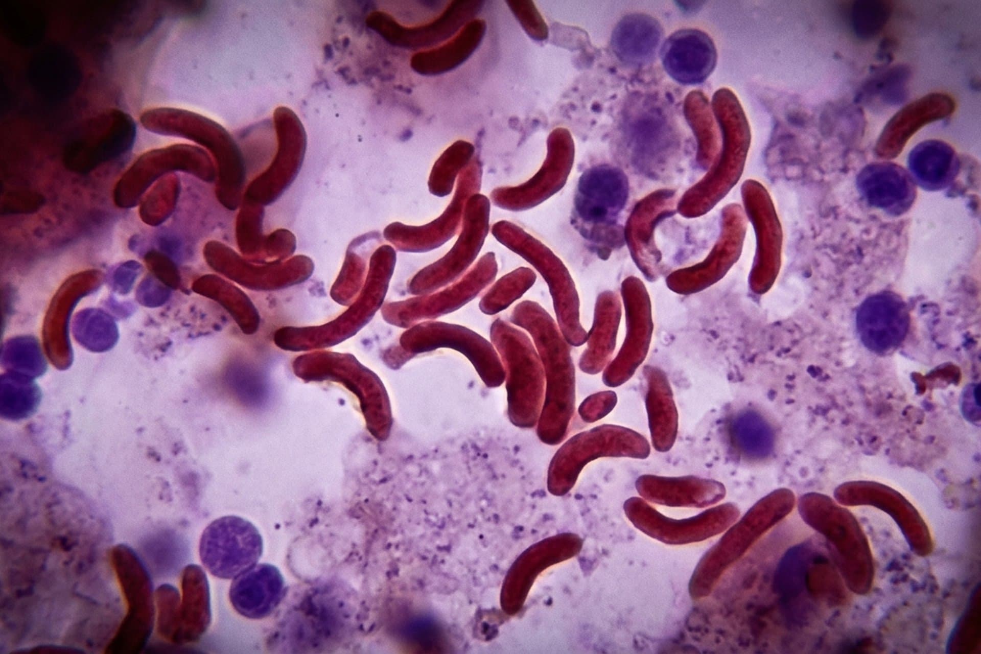 Klassische Cholera — medizin.studio
