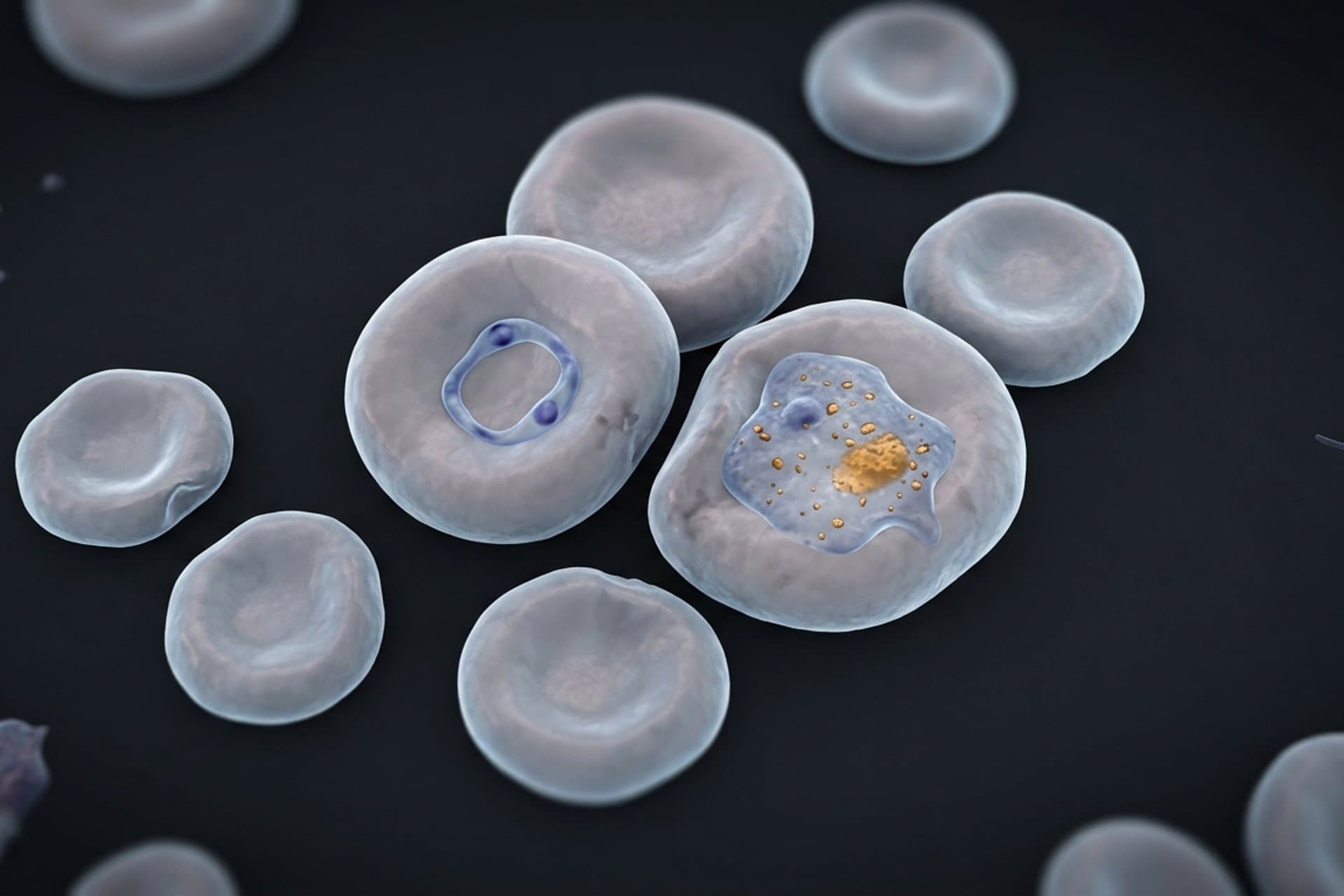 Malaria tertiana — medizin.studio