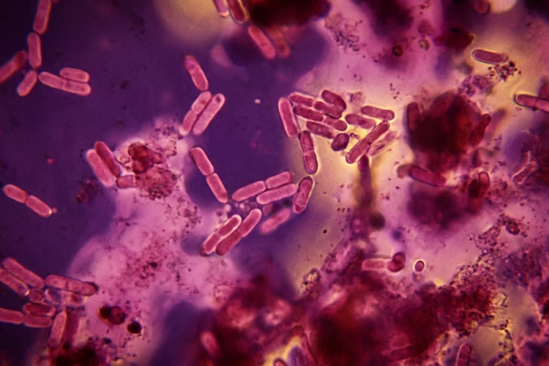Paratyphus C — medizin.studio