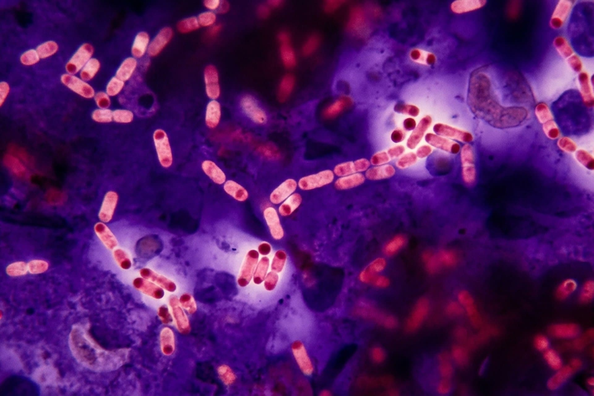 Pestmeningitis — medizin.studio