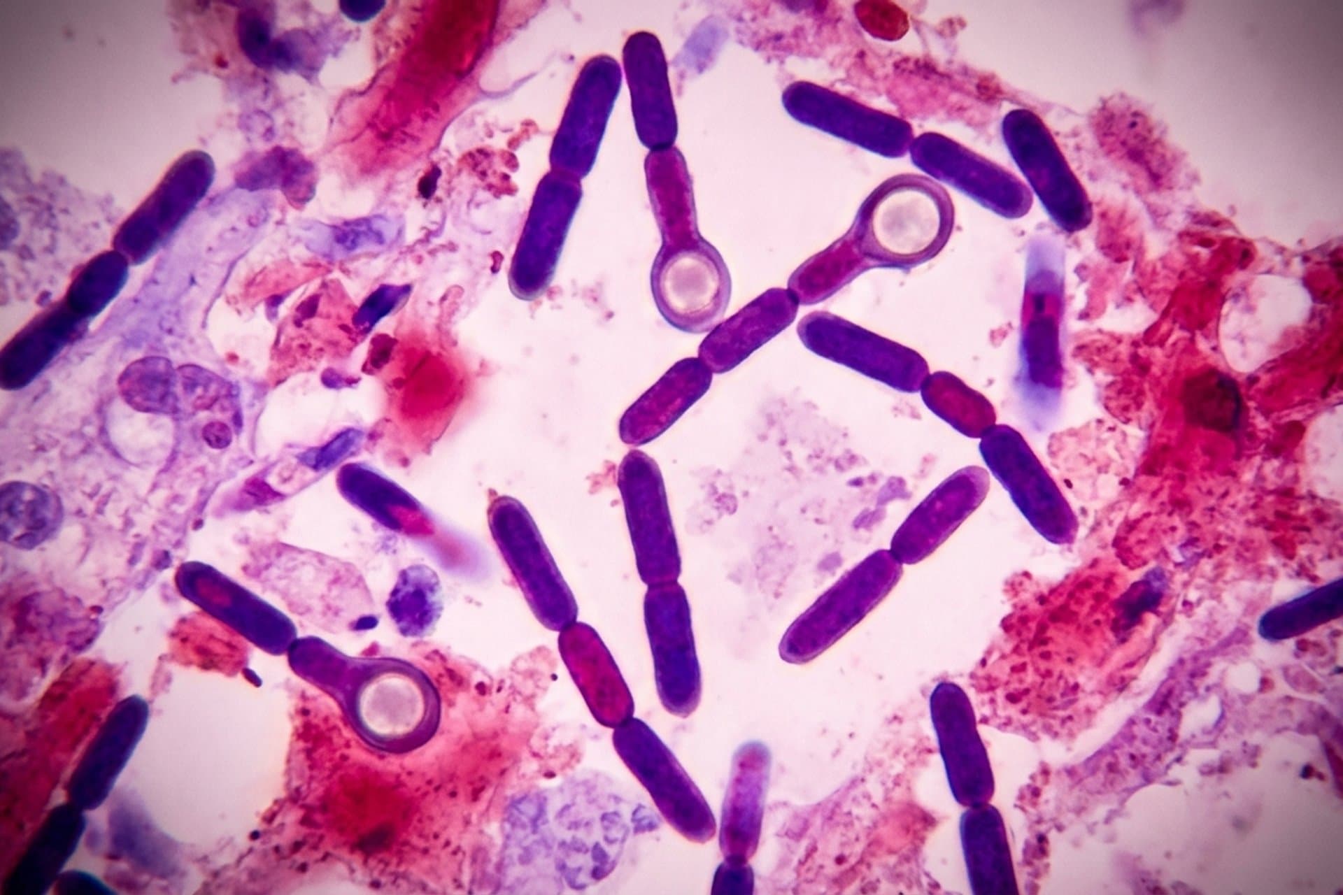 Tetanus während der Schwangerschaft, der Geburt und nach der Entbindung — medizin.studio